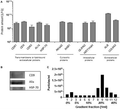 Profiling of plasma extracellular vesicles identifies proteins that strongly associate with patient’s global assessment of disease activity in rheumatoid arthritis